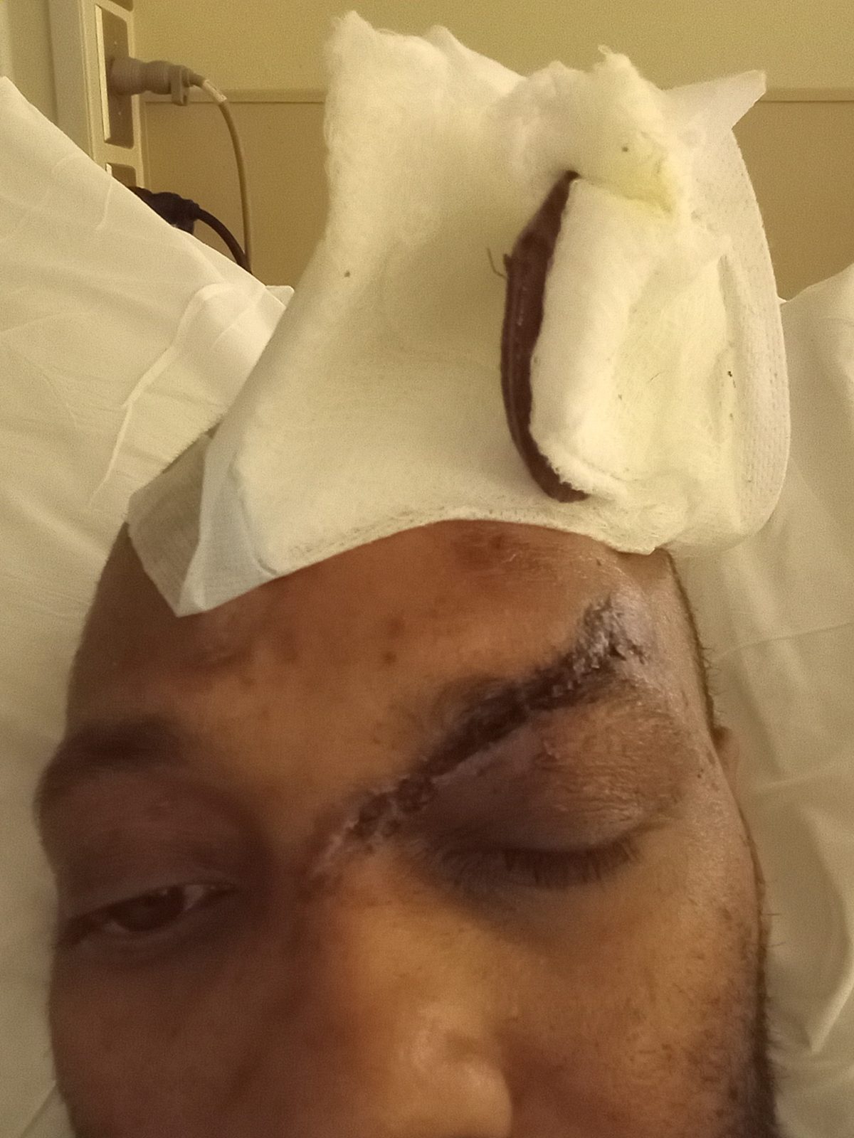 Hospital Recovery — Day One