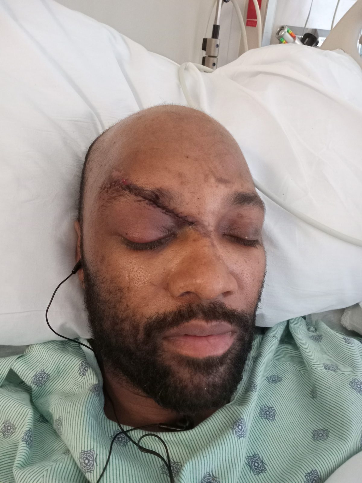 Healing Through The Pain