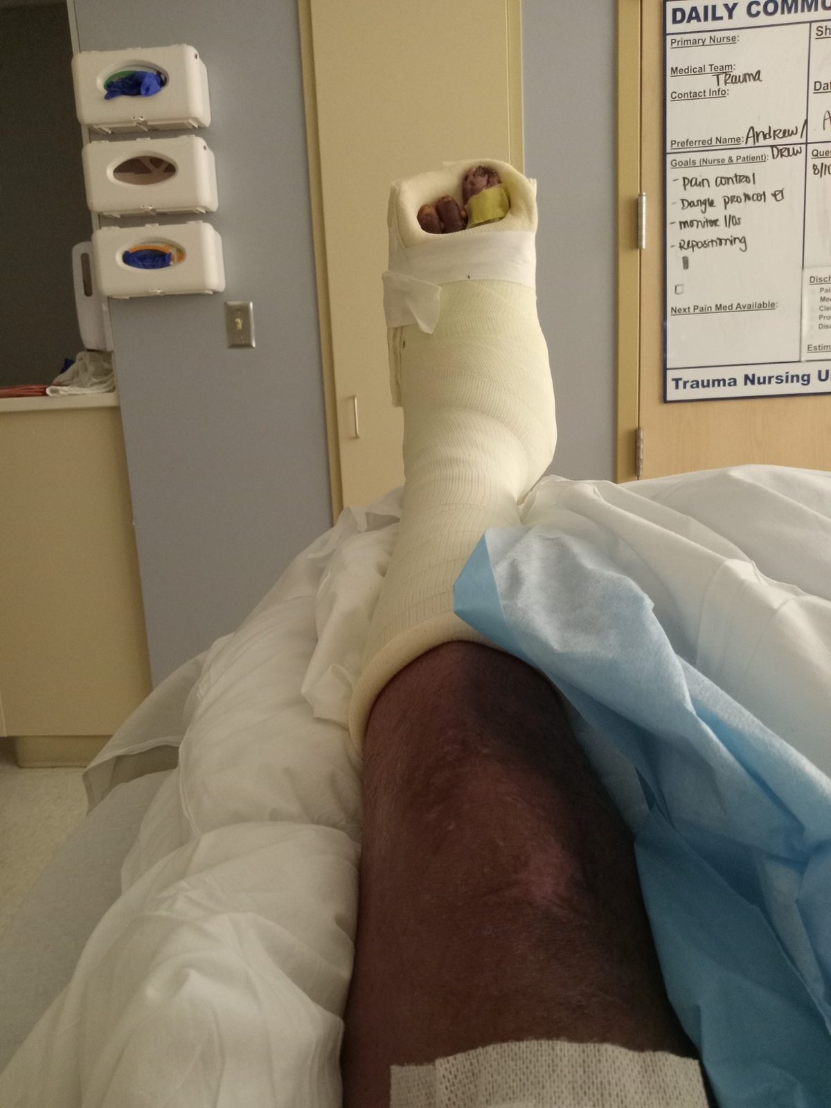 Foot Recovery Documentation