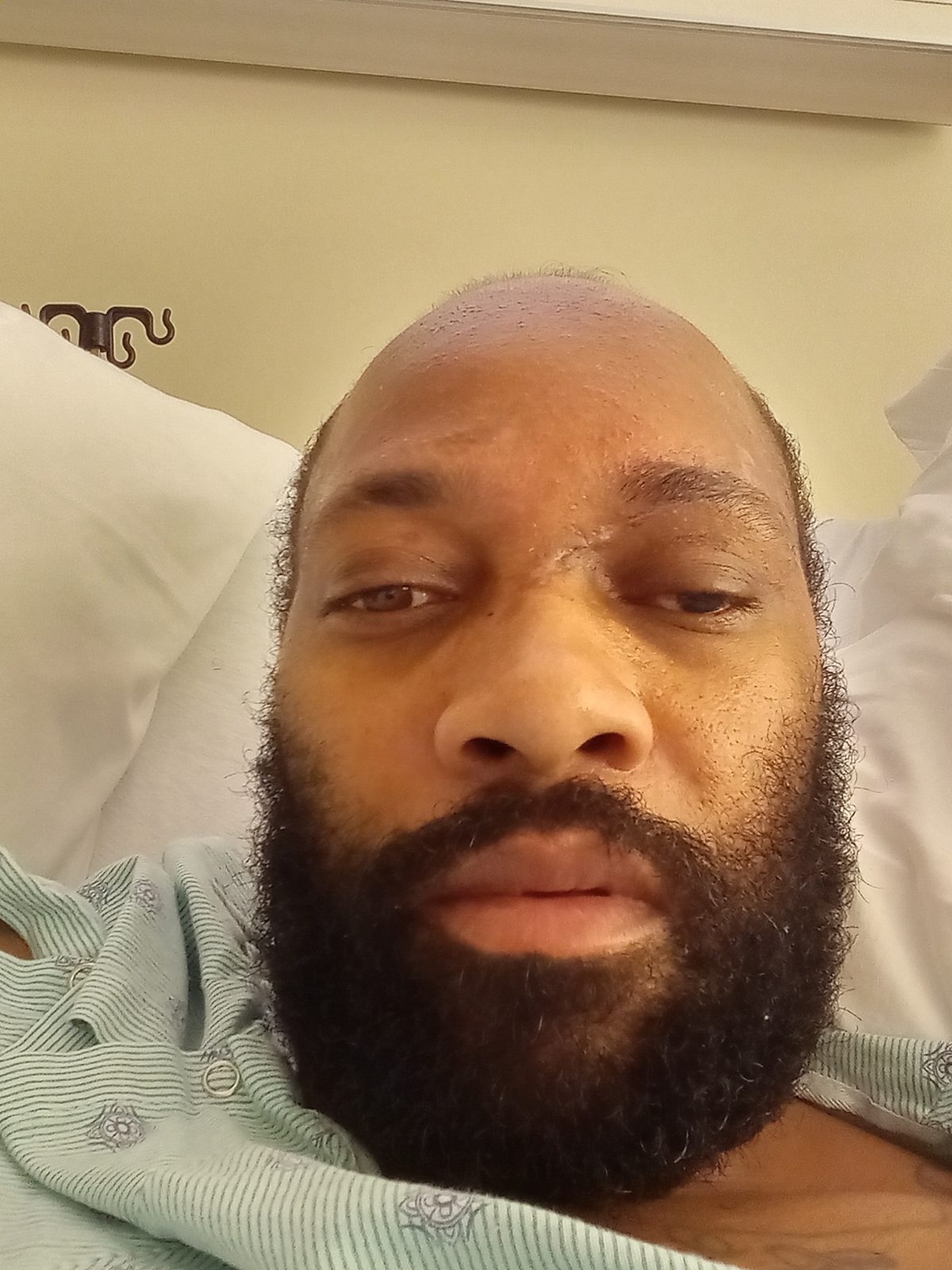 Long Incision Recovery